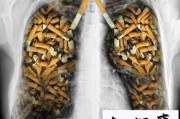 戒烟后，肺部还能恢复正常吗，需要多久 戒烟之后肺部多久恢复
